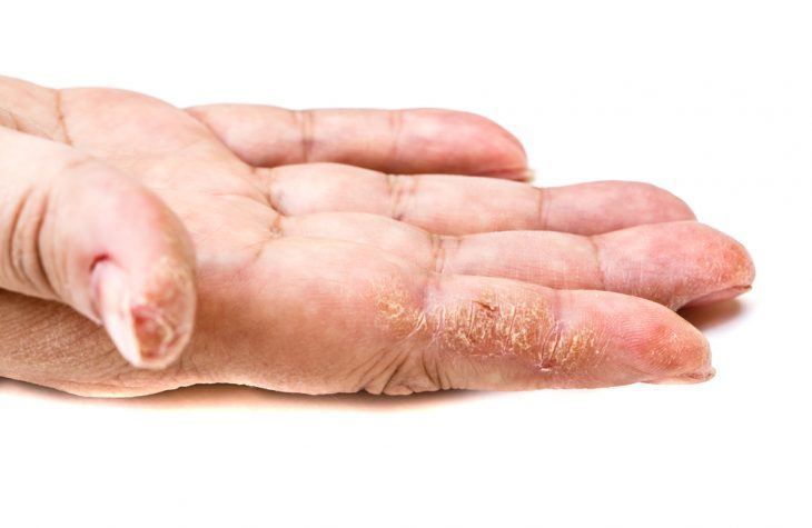 Використовуйте натуральні засоби для очищення рук