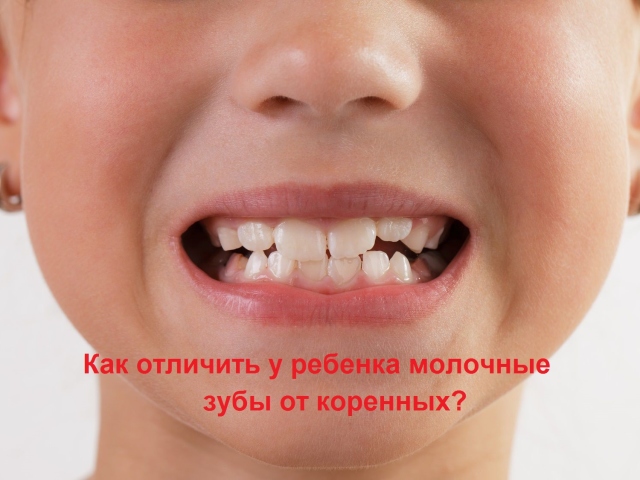Як відрізнити молочний зуб від корінного: фото з поясненнями. Зуб мудрості &#8212; корінний або молочний? Всі молочні зуби змінюються на корінні? Які існують проблеми, пов'язані зі зміною молочного зуба на корінний: коли робиться рентгенографія?