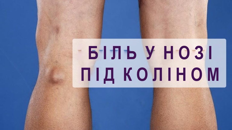 Чому болить під коліном: причини, ознаки хвороб, який лікар лікує. Біль під коліном ззаду: лікування препаратами, діагностика та профілактика захворювань, народні методи лікування