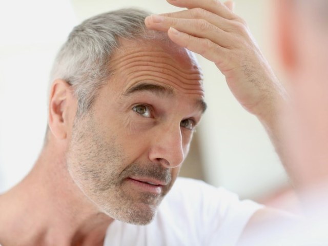 Чому випадає волосся у чоловіків і що з цим робити? Перші ознаки облисіння у чоловіків &#8212; як розпізнати? Як відновити волосся чоловікові при облисінні?
