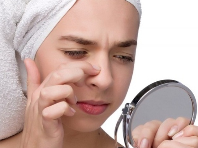 Прищі на носі: причини у жінок і чоловіків. Як позбутися від прищів на носі за один день?