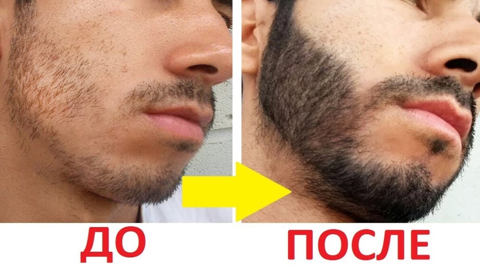 Професійні засоби для росту бороди: як вони допоможуть
