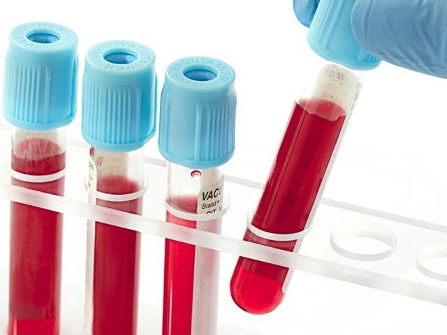 Лейкоцити в крові: види, норма. Підвищений або знижений рівень лейкоцитів у крові: причини &#8212; як привести в норму?