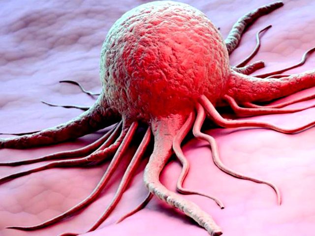 Як визначити рак по загальному аналізі крові, біохімічному, на онкомаркери? Що може спровокувати рак, які зовнішні ознаки раку? Що таке онкомаркери?