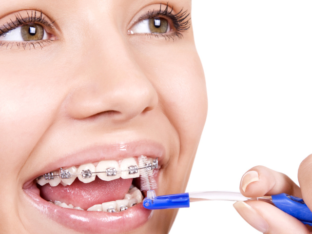 Як правильно чистити зуби з брекетами зубною щіткою дорослим і дітям: поради стоматологів, схема руху зубної щітки, вибір зубної щітки і зубної пасти