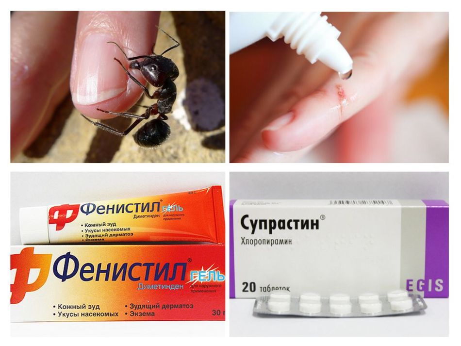 Засіб від укусів