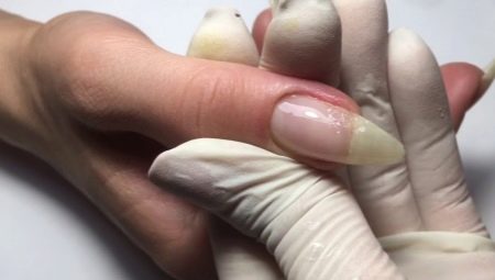Особливості нарощування зламаного нігтя