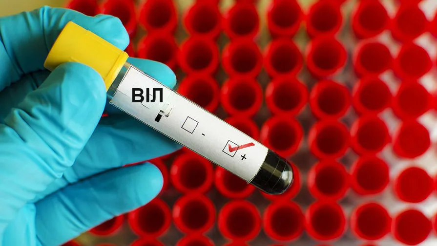 Аналіз на ВІЛ